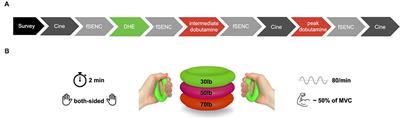 Dynamic Handgrip Exercise: Feasibility and Physiologic Stress Response of a Potential Needle-Free Cardiac Magnetic Resonance Stress Test
